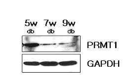 Fig. 47. PRMT1 expression in the liver of the db/db mouse during diabetogenesis.