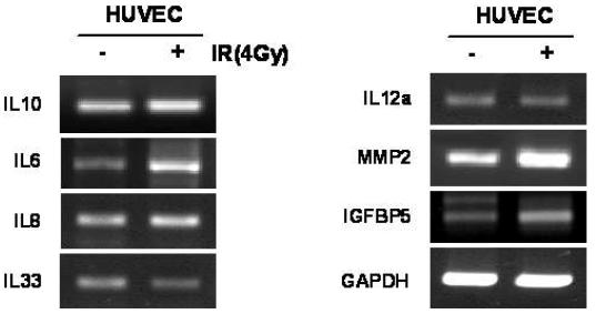 방사선에 의한 인터루킨, MMP, IGFBP의 변화