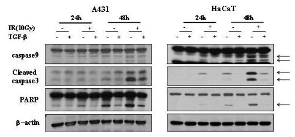 A431과 HaCaT에서 방사선 조사 시,TGF-beta1 처리에 따른 세포 사멸 관련 단백질들의 활성화 저해