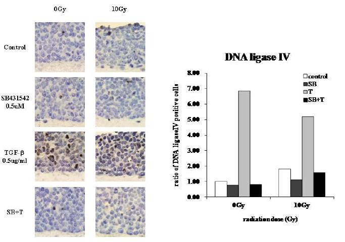 3차원 배양에서 방사선 조사 1시간 뒤 TGF-beta1 처리에 의한 DNA ligase IV의 발현 증가