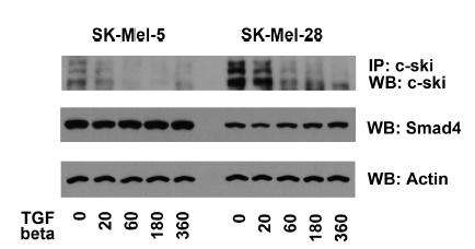 SK-mel-5, SK-mel-28에서의 시간별 TGF-beta1 처리에 따른 c-Ski