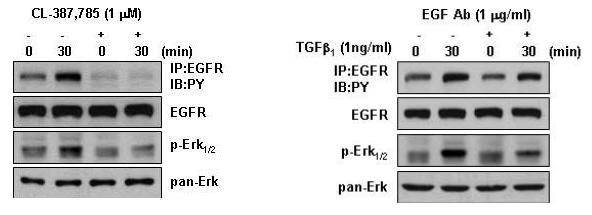 EFGR 활성 저해제에 의한 TGF-beta 효과 저해와