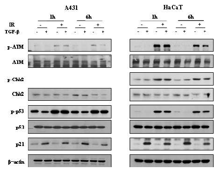 그림 ATM. A431과 HaCaT에서 TGF-beta1 처리에 따른 방사선에