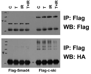 TGF-beta1 또는 방사선 조사에 따른 Ski와 Smad4의 ubiquitination 비교