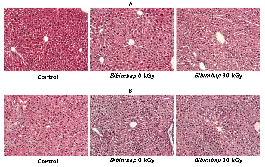 Histopathological examination of the liver of ICR mouse administered with freeze dried Bibimbap prepared with 30 kGy-irradiated Bibimbap for 3 months (A, Male; B, Female).