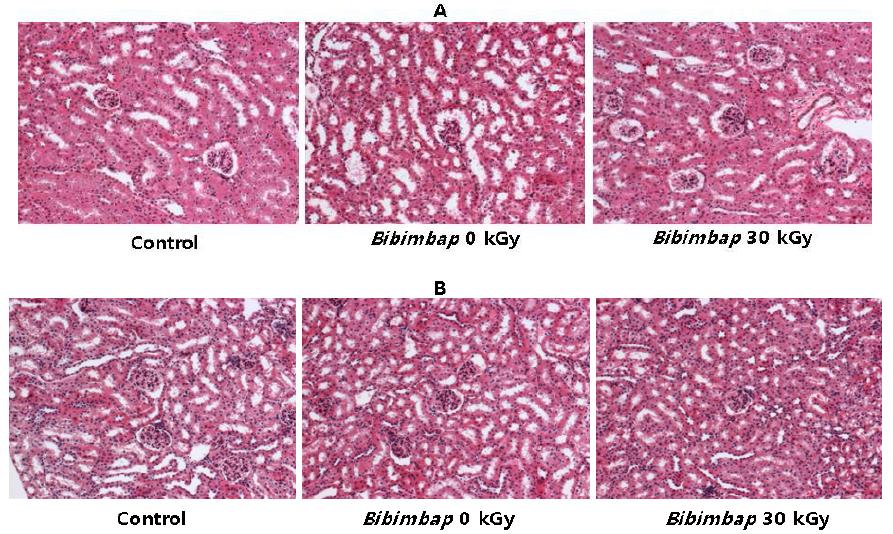 Histopathological examination of the kidney of ICR mouse administered with freeze dried Bibimbap prepared with 30 kGy-irradiated Bibimbap for 3 months (A, Male; B, Female).