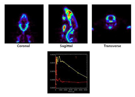 그림 45. 랫트에서 [18F]FCWAY의 microPET 이미지와 시간-방사능 곡선