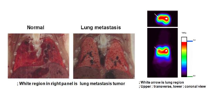 그림 62. LS174T-L 세포주의 정맥주사후 형성된 폐 전이암 모델의 동결절편 영상(좌측), 68Ga-NOTA-3E8 Fab의 소동물 PET 영상(우측)