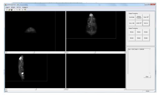 그림 102. PET 영상 데이터를 읽어들여 3차원적으로 분석할 수 있도록 스케일링과 영상확대 축소 그리고 영역 설정 소프트웨어 개발