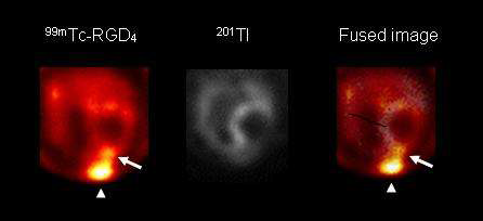 그림 130. 혈관형성 표적 방사성추적자([99mTc]HYNIC-RGD)를 이용한 허혈심근 영상 연구