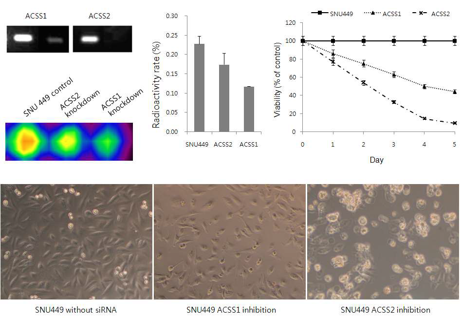 그림 138. 간암 세포주에서 Acetyl CoA Synthetase 억제에 의한 세포 사멸에 미치는 영향