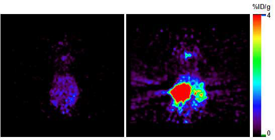 그림 142. [124I]FIAU의 소동물 PET 영상, MCA-TL 대조군(좌)과 MCA-TL 치료군(우)