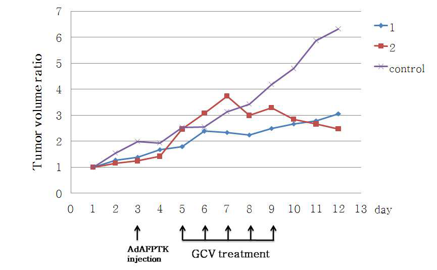 그림 145. GCV 치료 전·후의 종양크기 변화 모니터링