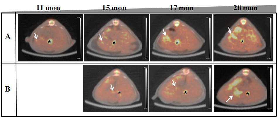 그림 151. [18F]FDG PET/CT를 이용한 HBx-Tg model의 간암진행과정의 지속적 모니터링
