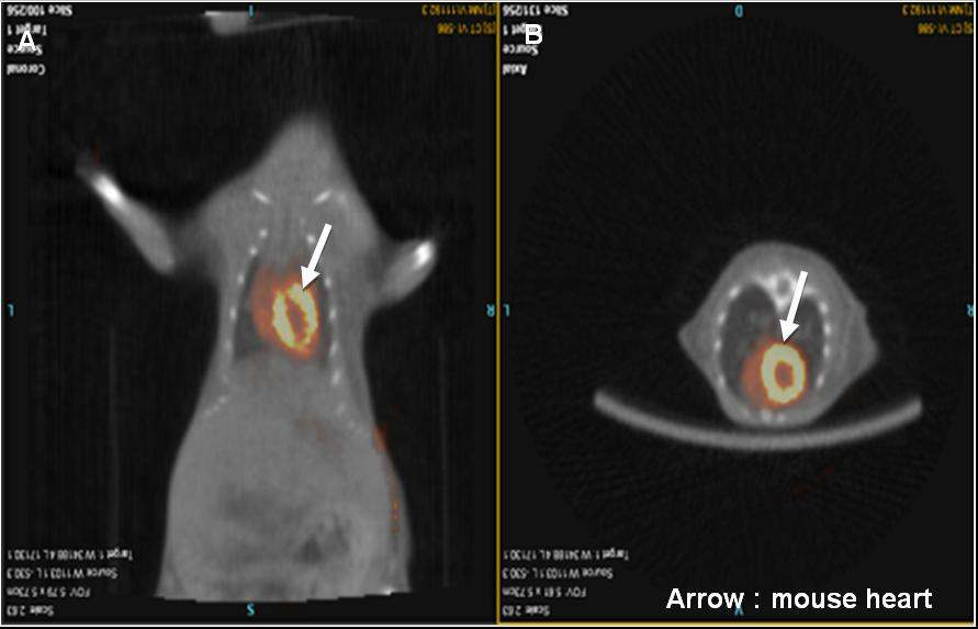 그림 161. 99mTc-pertechnate를 사용한 형질전환 마우스의 심장에서의 SPECT/CT 영상.