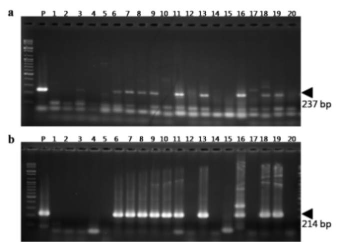 그림 18. 기내 배양묘 STC 29를 재료로 direct method 방법을 이용하여 RT-PCR 분석 결과
