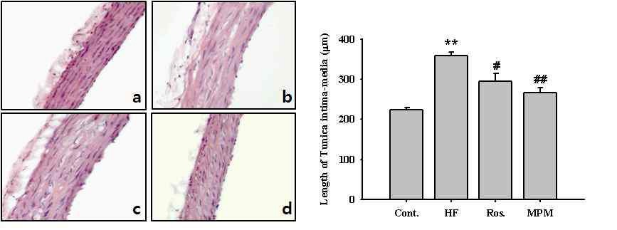 Fig. 3. Effect of MPM on anti-atherosclerosis in high fructose-diet rats. Representative microscopic photographs of aorta stained with hematoxylin and eosin