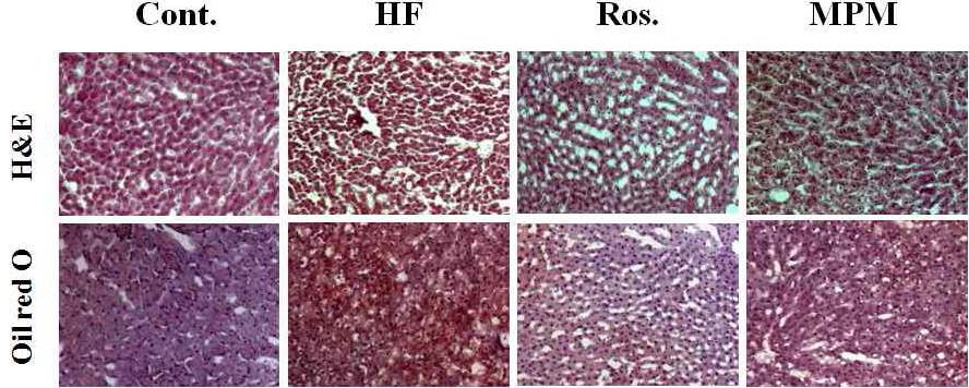 Fig. 4. Effect of MPM on microphotographs of the liver in high fructose-diet rats