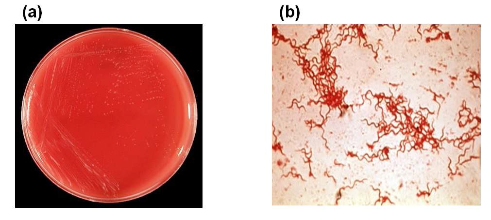 그림1. B. hyodysenteriae, (a) Blood agar 배지에서의 배양, (b) 현미경 관찰