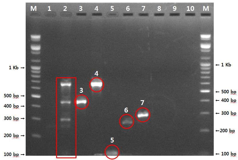 mutiplex PCR 산물의 전기영동 결과