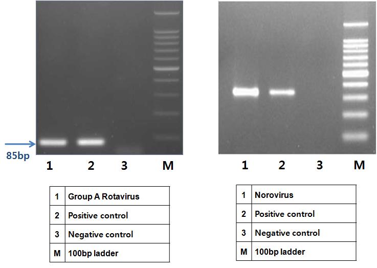 로타바이러스와 노로바이러스의 전기영동 결과