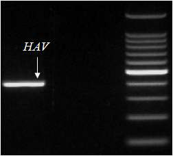 제작된 HAV Primer를 사용하여 RT-PCR 후 전기영동