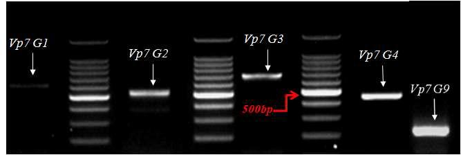 제작된 로타바이러스(VP7) Primer를 사용하여 RT-PCR 후 전기영동