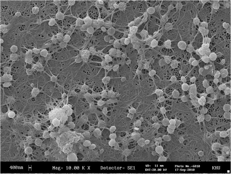 Amylosucrase 효소를 이용한 SWNT-Amylose 복합체 합성 반응 2시간 후의 결과를 주사전자현미경 (SEM) 으로 관찰한 사진