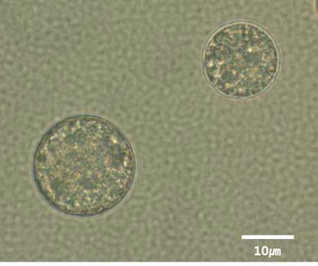 형성된 porous PLGA 마이크로 입자를 광학현미경으로 관찰한 이미지