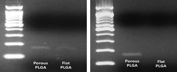 PLGA 마이크로 입자에 의해서 검출된 타겟 미생물의 독성 유전자를 PCR을 통해 증폭한 후 전기영동으로 확인한 결과. 두 번의 실험 모두 동일 조건에서 수행