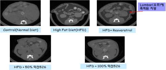 그림 4. 일반사료 및 레스베라트롤 쌀 급여 후 실험동물의 요추 micro-CT 사진