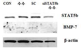 siSTAT5b를 통하여 수수B가 STAT5b와 BMP-7의 단백질 발현에 미치는 영향