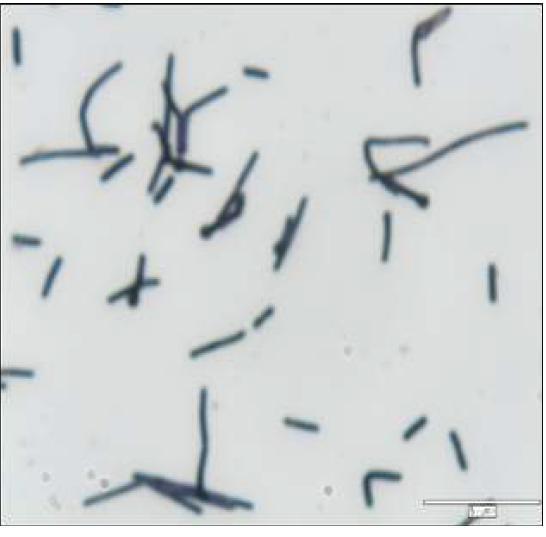 Phase-contrast microscopy of Methanobacterium formicicum KOR-1. Cells were straight or crooked rods. 5~15μm long. Bar; 5 μm