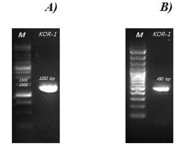 Agarose gel electrophoresis of PCR product. A) 16S rRNA gene and B) mcrA gene