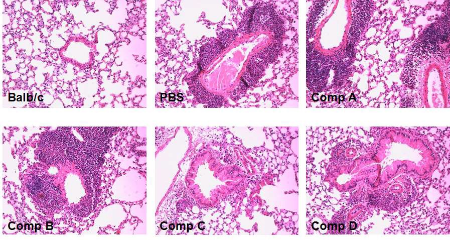 Fig. 32. Pulmonary histologic analysis by the recruitment of leukocytes and mucos production from mice treated with PBS or ethanol extracts.