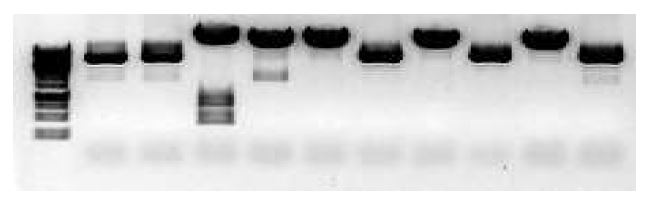 Fig. 37. Selection of pHGXT III by restriction enzyme digestion