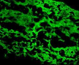 Confocal 측정을 통한 혼합 추출물 나노 입자의 세포 내 침투 효과