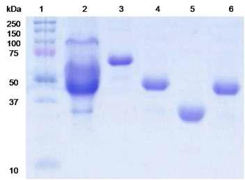 SDS-PAGE of BGL, CBH, EG, and xylanase purified from P . adiposa.
