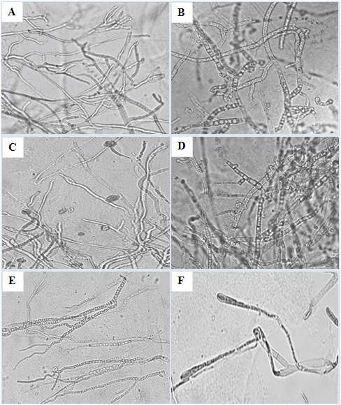 Fig. 12. Light microscopy visualization of B. cinerea mycelia treated with or without 5KHz sound waves. Mycelia treated without sound (control) (A) and with sound