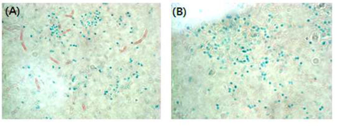 Fig. 60. Schaeffer-Fulton 염색하여 광학현미경으로 관찰(×1000)