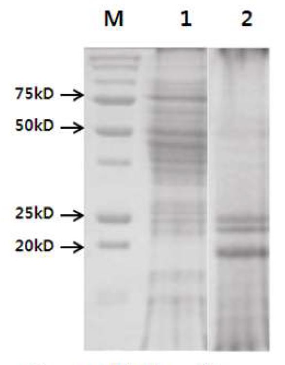 Fig. 63. Whole cell protein by SDS-PAGR gel