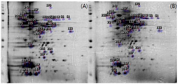Fig. 66. (A)planktonic cell과 (B) biolfilm 형성 cell의 단백질 비교
