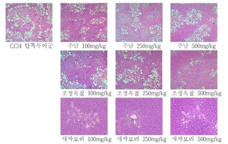 그림 20. 랫드 간기능 개선 모델에서 천연색소 추출물 투여로 인한 간조직의 변화 (H&E 염색)