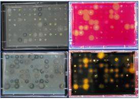 Fig. 1-2. Selection of enzyme producing bacteria