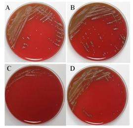 Fig. 4-18. Hemolysis test of the isolated lactic acid bacteria.