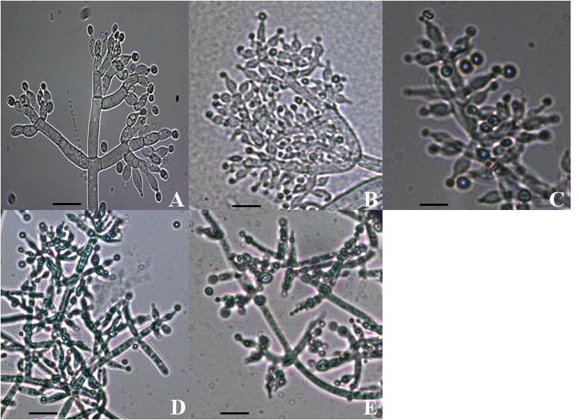 Conidiophores of Trichoderma spp. (scale bar = 10㎛).