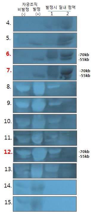 그림 10. 4~15번 항체를 비발정 자궁조직, 발정시 자궁조직 및 발정시 질내 점액에 Western Blot 발현 검정