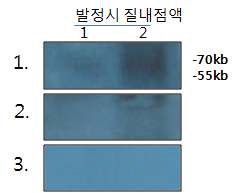 그림 9. 1~3번 항체를 발정시 질내점액에서 Western blot 발현 검정