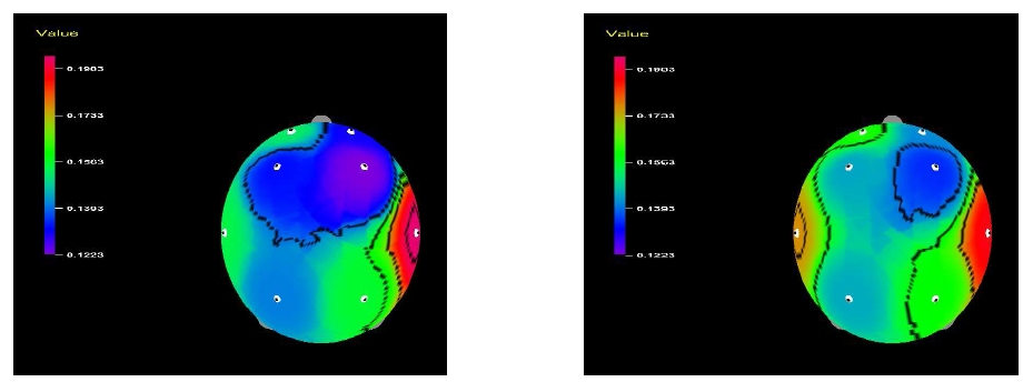 그림 12. 어수리 정유의 향 흡입 전(왼쪽)과 흡입 중(오른쪽)의 relative high beta power spectrum.