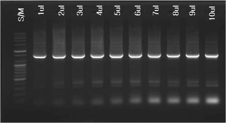 그림 30. Multiplex-PCR을 위한 세균 특이 primer 적정 농도 결정을 위한 PCR 결과